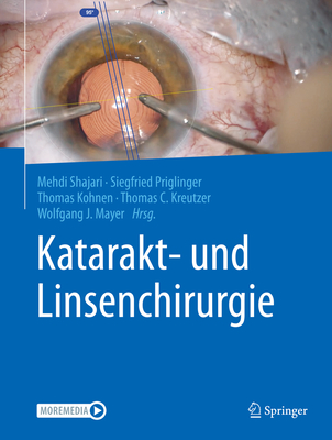 Katarakt- Und Linsenchirurgie - Shajari, Mehdi (Editor), and Priglinger, Siegfried (Editor), and Kohnen, Thomas (Editor)