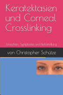 Keratektasien, Corneal Crosslinking: Ursachen, Symptome Und Behandlung