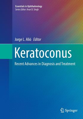 Keratoconus: Recent Advances in Diagnosis and Treatment - Ali, Jorge L (Editor)