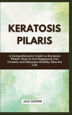 Keratosis Pilaris: A Comprehensive Guide to Keratosis Pilaris: How to Get Diagnosed, Get Treated, and Maintain Healthy Skin for Life - Cooper, Jace