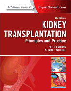 Kidney Transplantation with Access Code: Principles and Practice