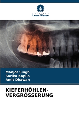 Kieferhhlen-Vergrsserung - Singh, Manjot, and Kapila, Sarika, and Dhawan, Amit