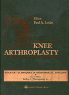 Knee Arthroplasty - Lotke, Paul A, MD