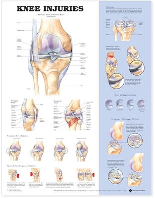 Knee Injuries Anatomical Chart - Acc, and Anatomical Chart Company (Editor)