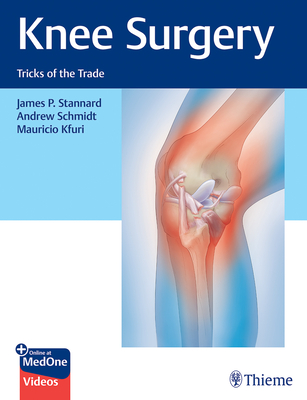 Knee Surgery: Tricks of the Trade - Stannard, James, and Schmidt, Andrew, and Kfuri, Mauricio