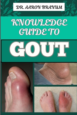 Knowledge Guide to Gout: Essential Manual To Symptoms, Treatments, Diets, And Natural Remedies For Lasting Relief - Branum, Aaron, Dr.