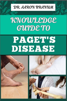 Knowledge Guide to Paget's Disease: Essential Manual To Symptoms, Diagnosis, Treatment Options, and Long-term Management - Branum, Aaron, Dr.