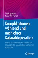 Komplikationen w?hrend und nach einer Kataraktoperation: Von der Phakoemulsifikation ?ber die sekund?re IOL-Implantation bis hin zum Kernverlust