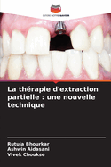 La th?rapie d'extraction partielle: une nouvelle technique