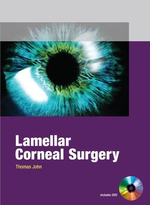 Lamellar Corneal Surgery - John, Thomas, MD