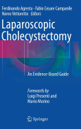 Laparoscopic Cholecystectomy: An Evidence-Based Guide