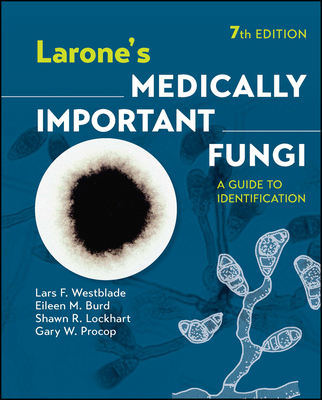 Larone's Medically Important Fungi: A Guide to Identification - Westblade, Lars F, and Burd, Eileen M, and Lockhart, Shawn R