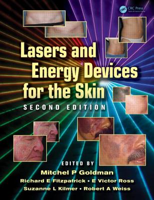 Lasers and Energy Devices for the Skin - Goldman, Mitchel P, MD (Editor), and Fitzpatrick, Richard E, MD (Editor), and Ross, E Victor (Editor)