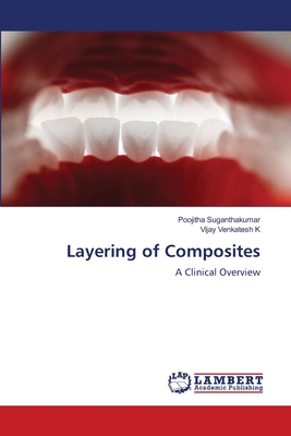 Layering of Composites - Suganthakumar, Poojitha, and Venkatesh K, Vijay