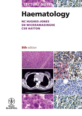 Lecture Notes: Haematology - Hughes-Jones, Nevin C., and Wickramasinghe, S. N, and Hatton, Chris