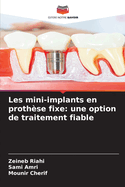 Les mini-implants en proth?se fixe: une option de traitement fiable