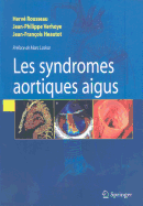 Les Syndromes Aortiques Aigus