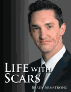 Life with Scars: A Guide to Emotionally Overcoming Physical Trauma