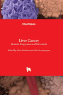 Liver Cancer: Genesis, Progression and Metastasis