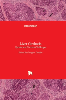 Liver Cirrhosis: Update and Current Challenges - Tsoulfas, Georgios (Editor)