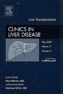 Liver Transplantation, an Issue of Clinics in Liver Disease: Volume 11-2