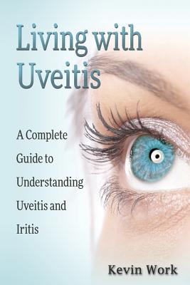 Living with Uveitis: A Complete Guide to Uveitis and Iritis - Work, Kevin