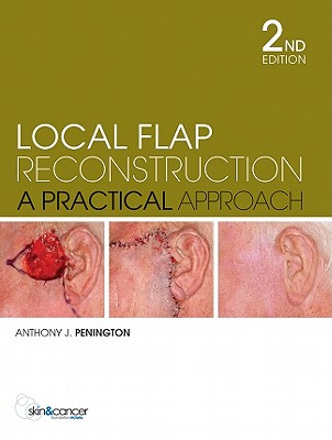 Local Flap Reconstruction - Penington, Anthony