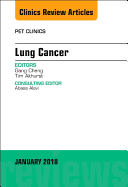 Lung Cancer, an Issue of Pet Clinics: Volume 13-1