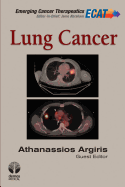 Lung Cancer