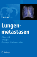 Lungenmetastasen: Diagnostik - Therapie - Tumorspezifisches Vorgehen