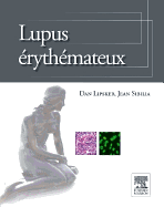 Lupus Erythemateux