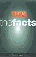 Lupus: The Facts