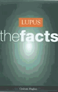 Lupus: The Facts - Hughes, Graham