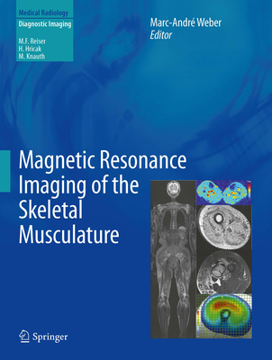 Magnetic Resonance Imaging of the Skeletal Musculature - Weber, Marc-Andr (Editor)