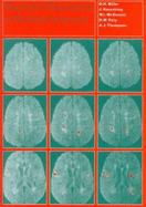Magnetic Resonance in Multiple Sclerosis - Miller, David H, and Kesselring, Jrg, and McDonald, W Ian