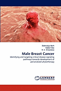 Male Breast Cancer