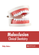 Malocclusion: Clinical Dentistry