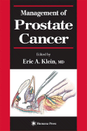 Management of Prostate Cancer