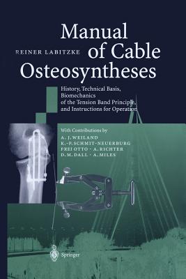 Manual of Cable Osteosyntheses: History, Technical Basis, Biomechanics of the Tension Band Principle, and Instructions for Operation - Labitzke, Reiner, and Weiland, A J (Contributions by), and Schmit-Neuerburg, K -P (Contributions by)