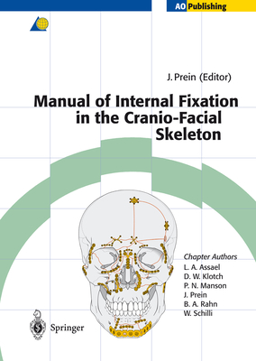 Manual of Internal Fixation in the Cranio-Facial Skeleton: Techniques Recommended by the AO/ASIF Maxillofacial Group - Prein, Joachim (Editor), and Assael, L.A. (Contributions by), and Klotch, D.W. (Contributions by)