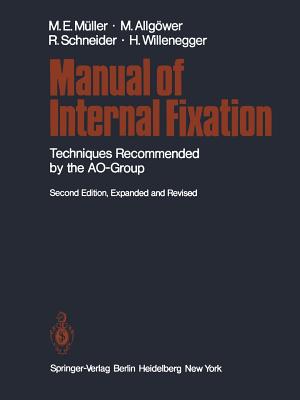 Manual of Internal Fixation: Techniques Recommended by the Ao Group - Mller, Maurice E, and Schatzker, J (Translated by), and Bandi, W