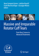 Massive and Irreparable Rotator Cuff Tears: From Basic Science to Advanced Treatments