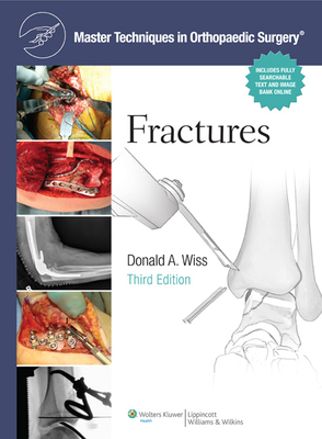Master Techniques in Orthopaedic Surgery: Fractures - Wiss, Donald, MD