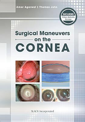 Mastering Corneal Surgery: Recent Advances and Current Techniques - Agarwal, Amar, Dr., MS, Frcs, and John, Thomas, MD