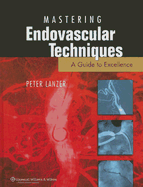 Mastering Endovascular Techniques: A Guide to Excellence - Lanzer, Peter