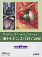 Mastering Orthopedic Techniques: Intra-Articular Fractures