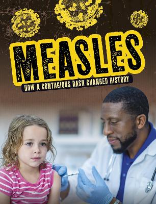 Measles: How a Contagious Rash Changed History - Lewis, Mark K.