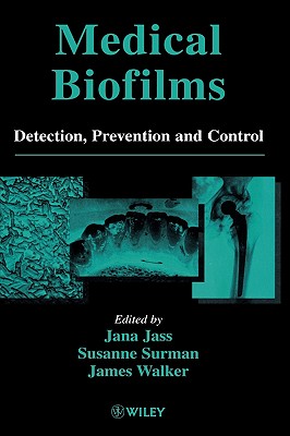 Medical Biofilms: Detection, Prevention and Control - Jass, Jana (Editor), and Surman, Susanne (Editor), and Walker, James (Editor)