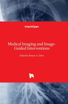 Medical Imaging and Image-Guided Interventions - Sebro, Ronnie A. (Editor)