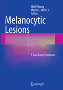 Melanocytic Lesions: A Case Based Approach
